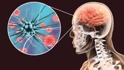 Nguy hiểm bệnh viêm não mô cầu