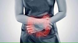 Viêm đại tràng có thể ngăn ngừa bằng phương pháp nào?