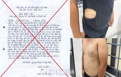 Tự gây thương tích, dựng chuyện bị cướp 40 triệu đồng để báo tin giả