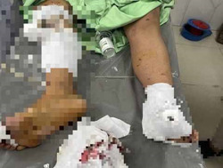 Tăng cường các biện pháp phòng, chống việc tự chế pháo nổ trong học sinh