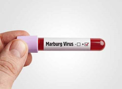 Chủ động phòng bệnh Marburg