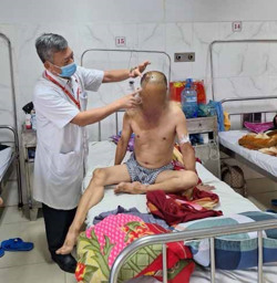 Bệnh viện Đa khoa vùng Tây Nguyên: Cấp cứu thành công một bệnh nhân chấn thương sọ não nặng do bị ném đá