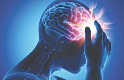 'Sát thủ thầm lặng' khiến đột quỵ ngày càng trẻ hóa