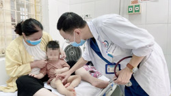 Các dấu hiệu trở nặng của bệnh tay chân miệng